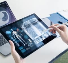 The global X-ray devices market is estimated to grow at a CAGR of 5.14% from a market size of USDX10.793 billion in 2019 to a market size of USD14.580 billion by 2025