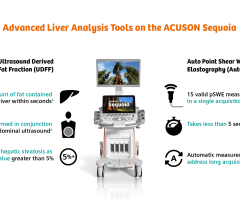 Auto Point Shear Wave Elastography (Auto pSWE) with Ultrasound derived fat fraction (UDFF) are innovative Advanced Liver Analysis tools, available for use on the ACUSON Sequoia ultrasound system.