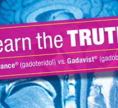 Results were presented at RSNA19 for the comparison of ProHance (Gadoteridol) Injection, 279.3 mg/mL and Gadavist (gadobutrol) Injection in MRI of the brain (the TRUTH study)