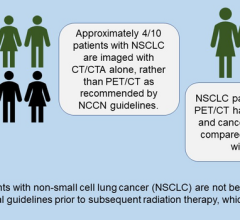 Summary of imaging findings from the SEER-Medicare linked database for patients with non-small cell lung cancer prior to receiving subsequent radiation therapy. Image created by Emily Sterbis, MD, Interventional Radiology Resident at the University of Colorado 