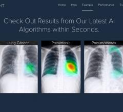 Lunit Insight Offers Cloud-Based AI Analysis for Chest X-rays