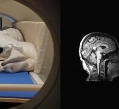 Two people together in an MRI Scanner along with the accompanying image of their brains