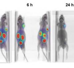Double Targeting Ligands to Identify and Treat Prostate Cancer