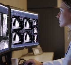 Philips Rolls Out  Next-Gen Web-based Diagnostic Viewer