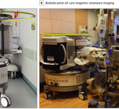 All intensive care unit equipment, including ventilators, pumps, and monitoring devices, as well as the point-of-care magnetic resonance image operator and bedside nurse, remained in the room. All equipment was operational during scanning.