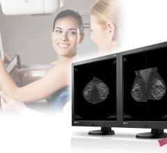Eizo, RadiForce GX540, FDA 510(k) clearance, breast tomosynthesis, medical monitor