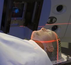 150-Year-Old Drug Might Improve Radiation Therapy for Cancer
