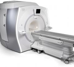  GE Signa PET/MR Improves Image Quality With Time-of-Flight Capability