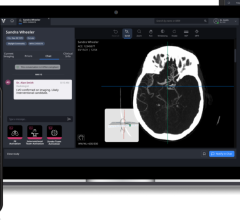  The new algorithm uses AI to detect suspected cerebral aneurysms, enabling hospital systems to ensure that once detected, patients are captured and the aneurysm workflow across an entire health system is standardized.