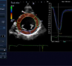 Echocardiographic Evaluation of Cancer Patients