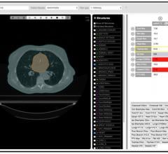 Siris Medical Releases PlanMD Decision Support Software