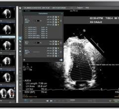Core Sound Imaging, a leader in cloud-based clinical imaging workflow management, announced the 6.0 release of the company’s innovative cloud-based medical image storage and reporting solution, Studycast. 