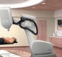 clinical trial study radiation therapy prostate technology accuray cyberknife