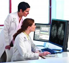 mammography reporting software pacs accessories RSNA 2013 carestream women