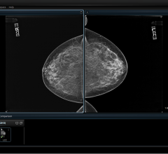 mammography reporting software breast imaging workstations cerner radnet RSNA