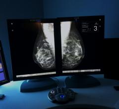 Densitas, Research Edition, mammography, breast density, ECR 2015