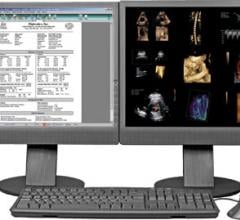 Digisonics, OB-View PACS and Structured Reporting System, OB/GYN, ultrasound, RSNA 2016