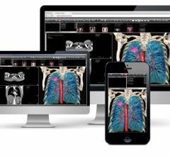 Voyager Integrates HDVR Into Fovia Web-enabled PACS