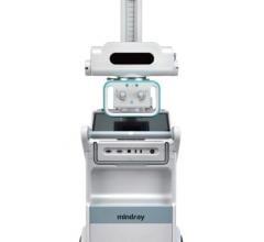 mobieye 700, Mindray, X-ray system