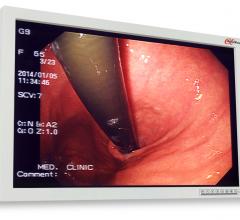 AlphaView Introduces 24-inch Surgical Display