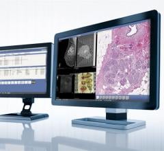 Sectra, RSNA 2015, digital pathology, radiology, integrated solutions, cancer care