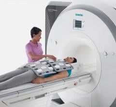 Siemens, Biogen, joint development, MRI tools, multiple sclerosis