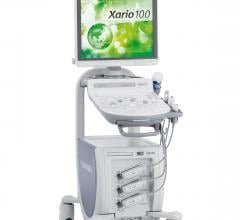 Toshiba, Xario 100, ultrasound, RSNA 2015