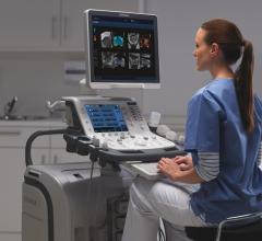 Toshiba, Aplio 500 Platinum cardiovascular ultrasound, Trinity Mother Frances, East Texas