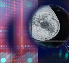 A recent study earlier this year in the journal Nature, which included researchers from Google Health London, demonstrated that artificial intelligence (AI) technology outperformed radiologists in diagnosing breast cancer on mammograms