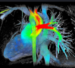 GE ViosWorks, now with Arterys software, large image datasets of the whole chest can be post processed and evaluated in real-time via cloud technology.