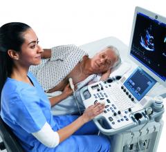 ASE Launches Challenge to Foster Innovation in Cardiovascular Ultrasound Workflow