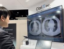 David Lai shares the latest advancements from ClariPi during a demonstration of the ClariCT denoising solution offered to ITN's editorial team during RSNA 2023.