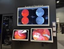 LG's new 55-inch 4K Surgical Monitor (model 55MH5K) features PIP and 4PBP capability