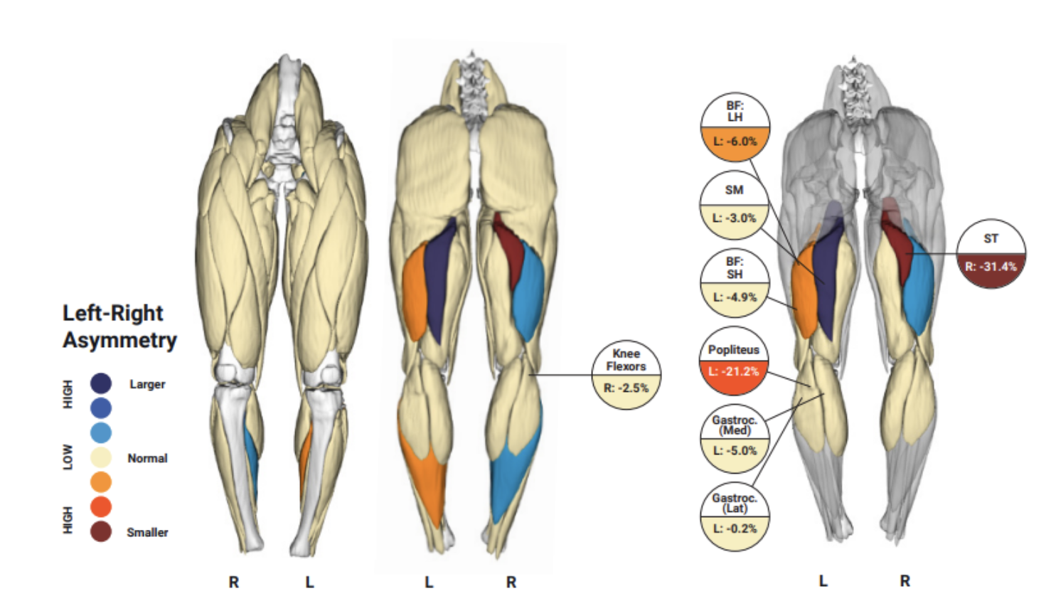 Immunis Partners with Springbok Analytics on MRI-based AI Muscle Analysis Technology