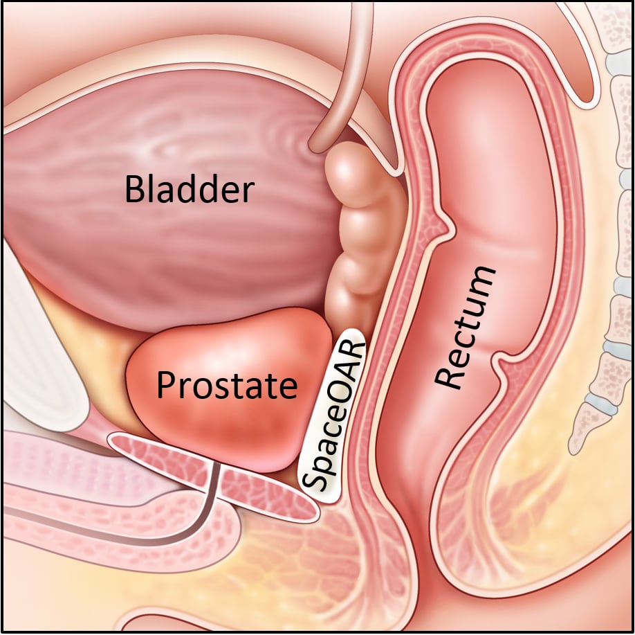 Mulhall, John P.: Sexual Function in the Prostate Cancer Patient | bookline