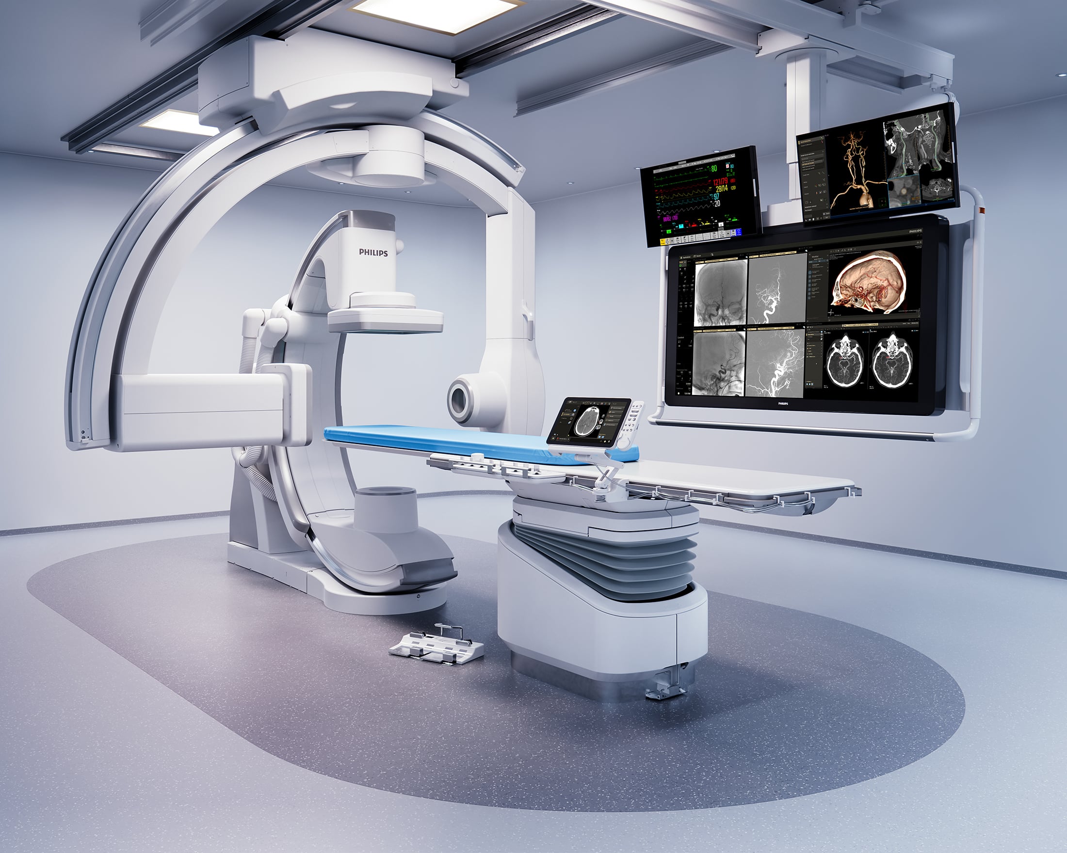 Philips Launches New Azurion Neuro Biplane System at #ECR2024 to Speed Up and Improve Minimally Invasive Diagnosis and Treatment of Neurovascular Patients - Vimarsana News