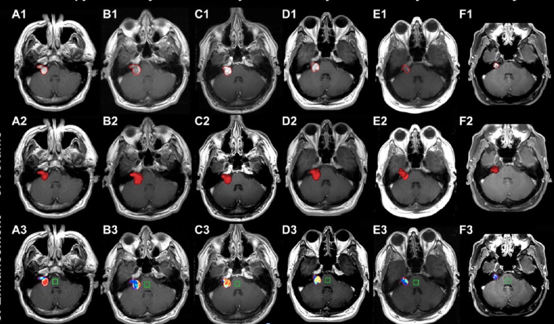 Imaging Biometrics and Medical College of Wisconsin Awarded NIH Grant
