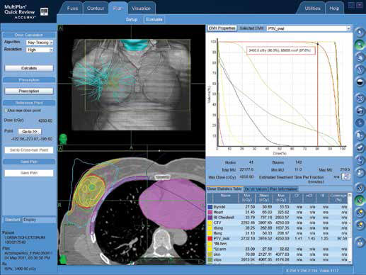 The TomoTherapy and CyberKnife Systems Highlight Quality of Care for Cancer Patients