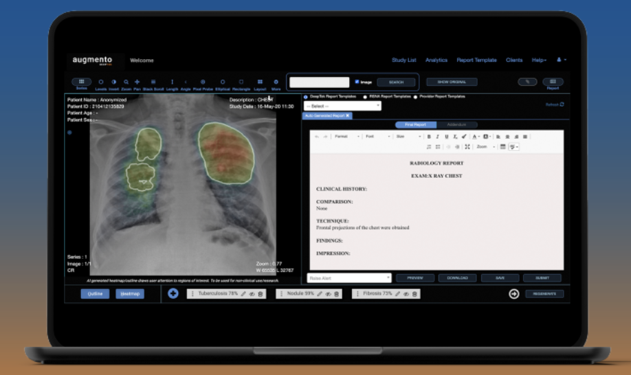 Deetptek.ai Showcases Chest X-ray AI solution, Augmento X-ray, at HIMSS 2024 - Vimarsana News