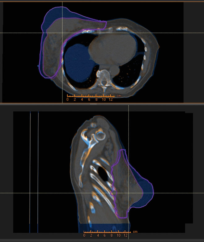 Original treatment plan