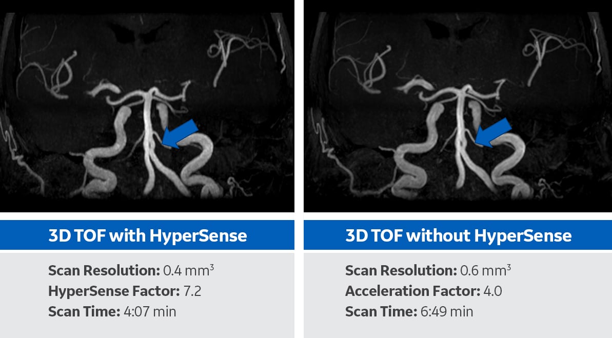  Hyper Sense Feature.