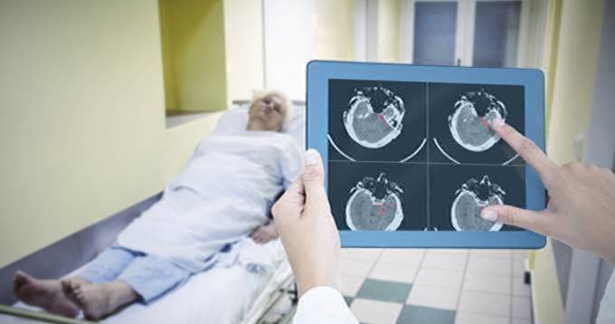 RSNA Announces Intracranial Hemorrhage AI Challenge