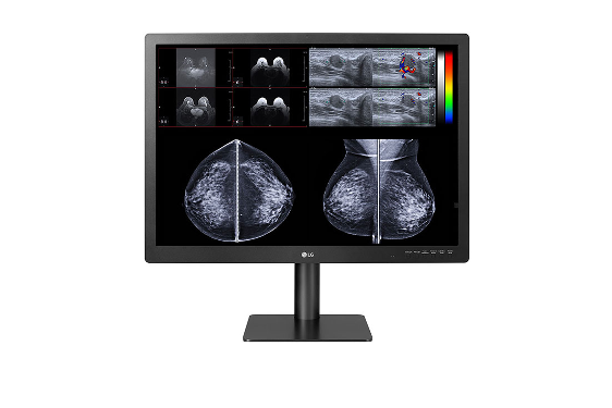 LG Expands Diagnostic Medical Monitor Line with New 12-megapixel Multimodality Display - Vimarsana News