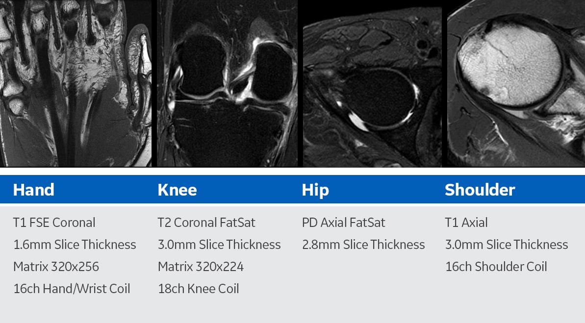 MRI