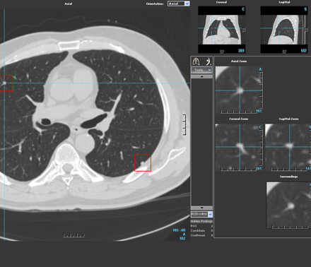 Median Technologies launches Imaging Lab