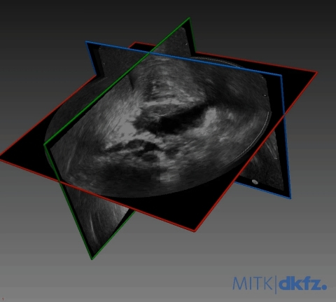 RSIP Vision Launches AI-based Tool For Prostate MRI and Ultrasound Registration - Vimarsana News