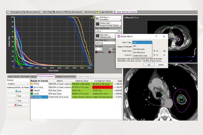 Automated 3D Dose-volume Verification: Gearing Up for Complex Planning scenarios - Vimarsana News