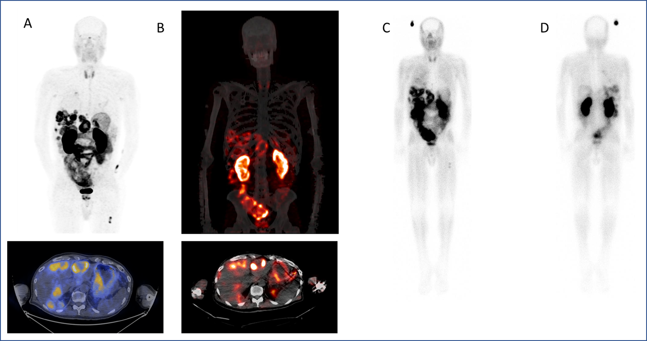 Image of the Year and Research Announced at SNMMI 2023 on Theranostic Pair for Early Detection and Effective Treatment of Pancreatic Cancer - Vimarsana News