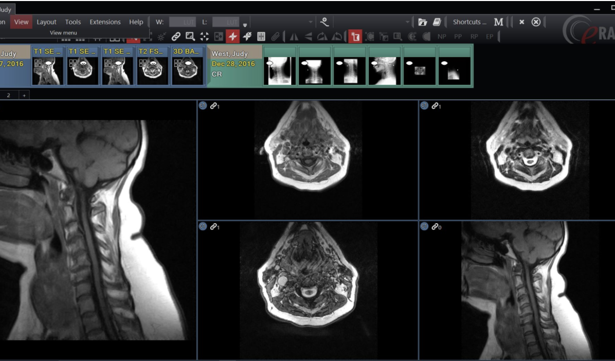 DeepHealth to Present Latest Results from AI-powered Screening and Diagnostic Programs at the European Congress of Radiology 2024