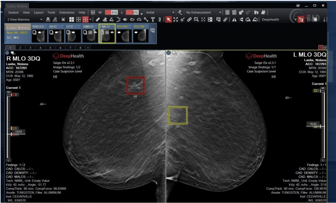DeepHealth and Incepto Announce Strategic Partnership to Expand Access to AI-powered Medical Imaging - Vimarsana News